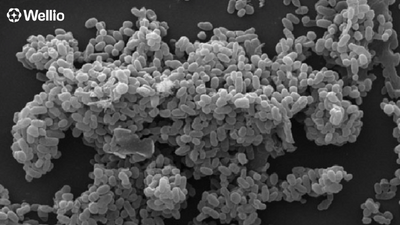 Akkermansia Muciniphila