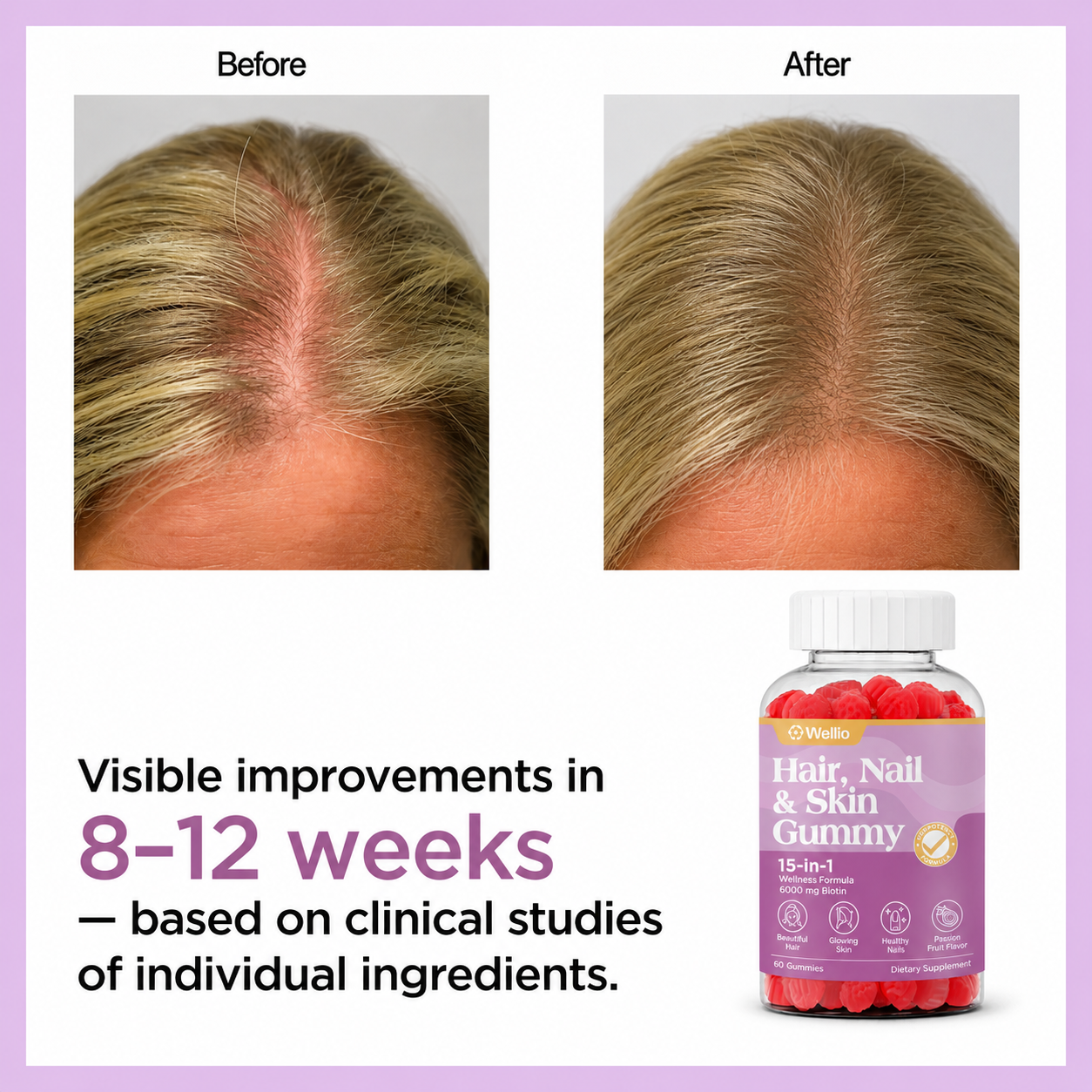 Wellio Hair, Nail & Skin Gummy 15-in-1