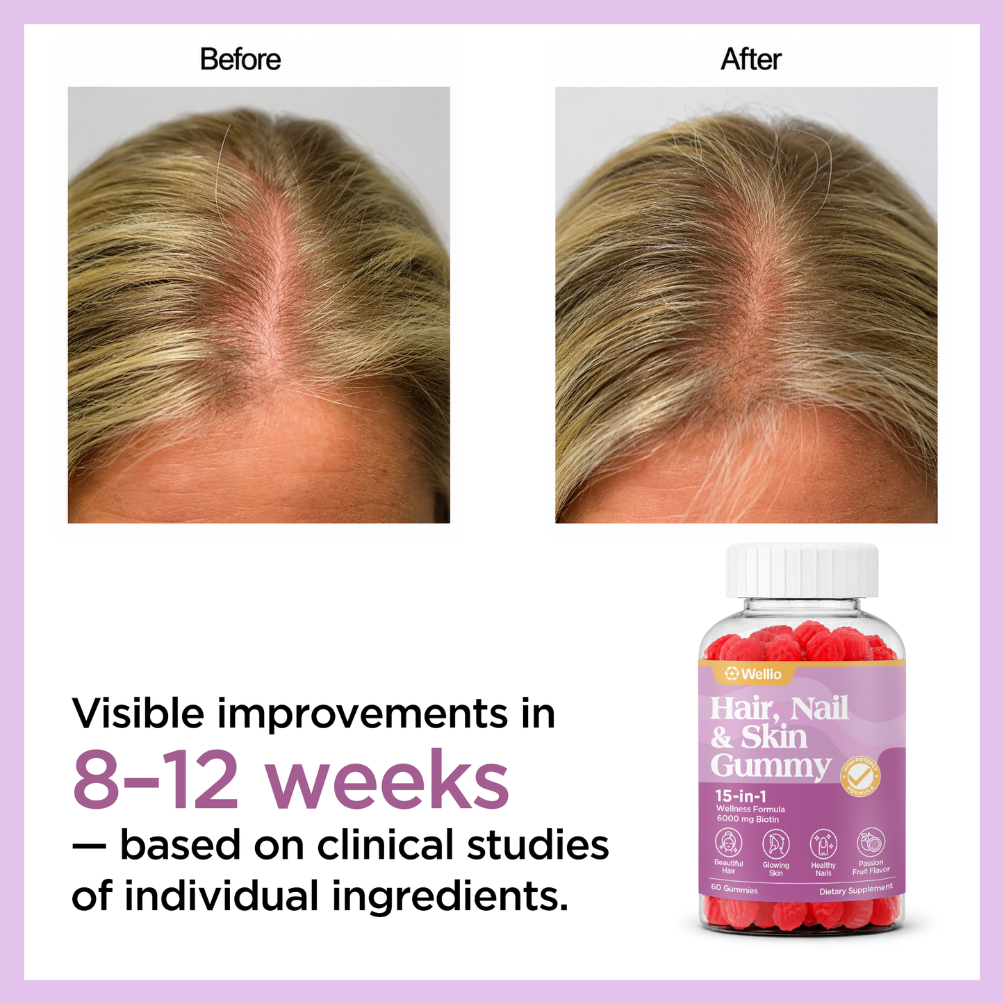 Wellio Hair, Nail & Skin Gummy 15-in-1